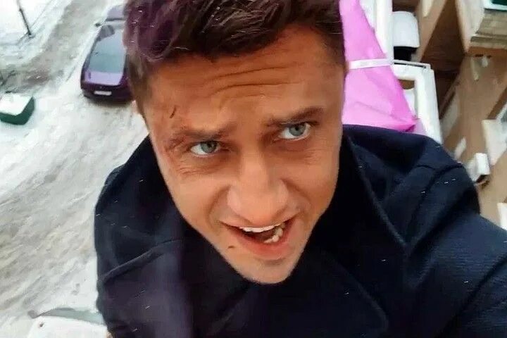 Павел прилучный фото до и после Перекошенное лицо: Павел Прилучный показал, как изменился после побоев и пластич