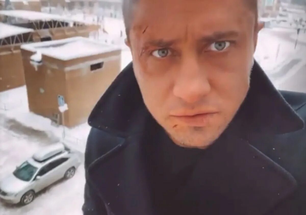 Павел прилучный фото после операции Шрамы на лице Павла Прилучного напугали поклонников в Instagram Донбасс Сегодня