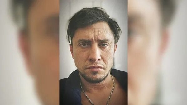 Павел прилучный фото после операции Прилучный показал селфи после полученных травм и операции на лице