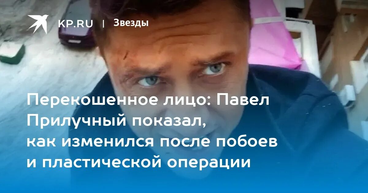 Павел прилучный фото после операции Перекошенное лицо: Павел Прилучный показал, как изменился после побоев и пластич