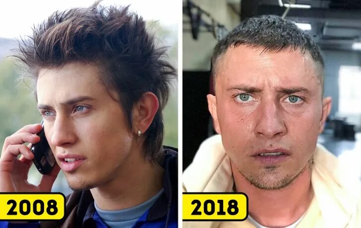Павел прилучный фото после операции Посмотрите, как выглядели 10 лет назад звезды российской эстрады (Спойлер: Макси