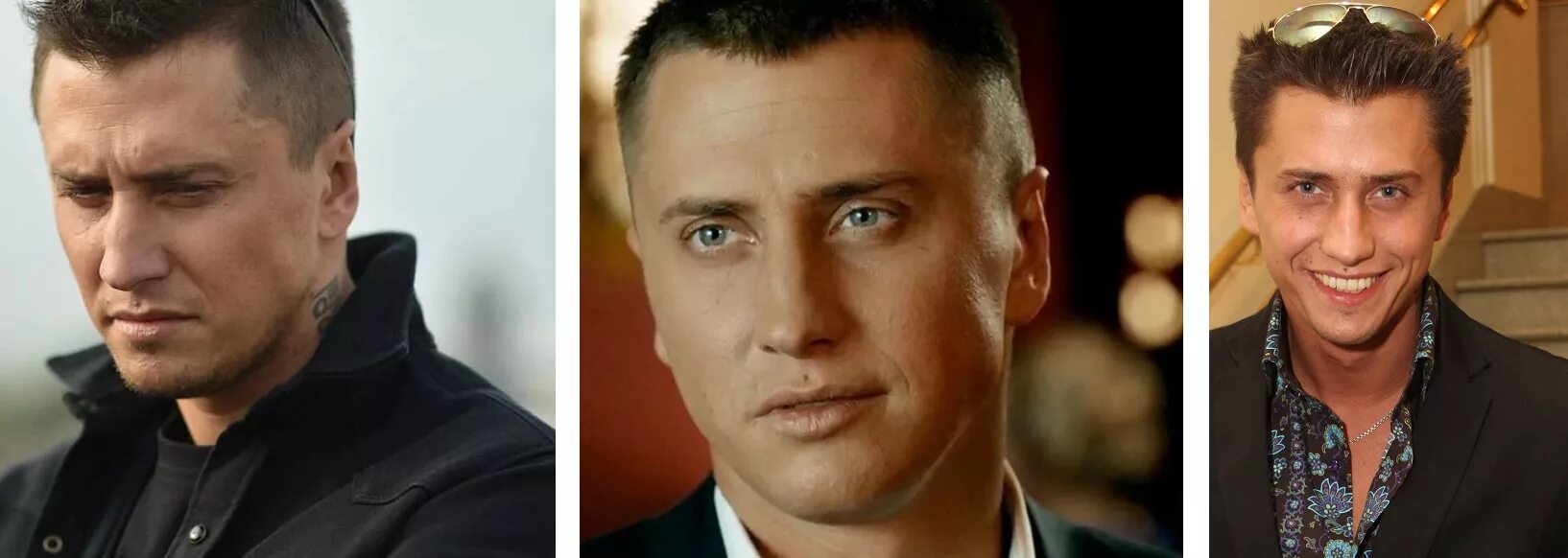 Павел прилучный фото уши Прилучный уши до и после