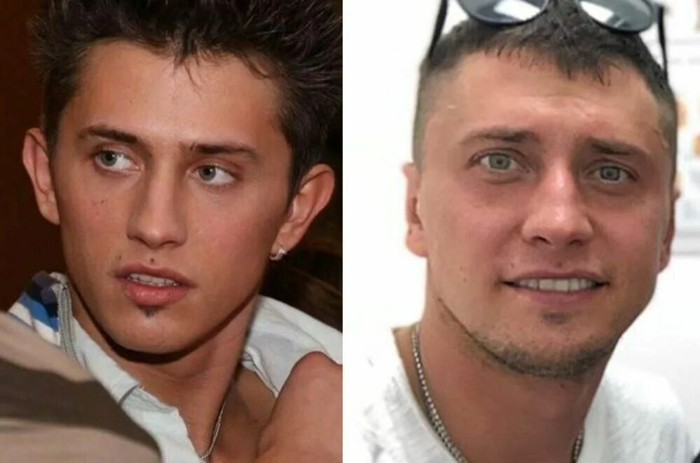 Павел прилучный операция фото Пластика Павла Прилучного (фото)