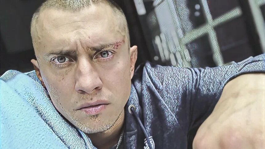 Павел прилучный операция фото Стало известно, кто мог избить актера Павла Прилучного