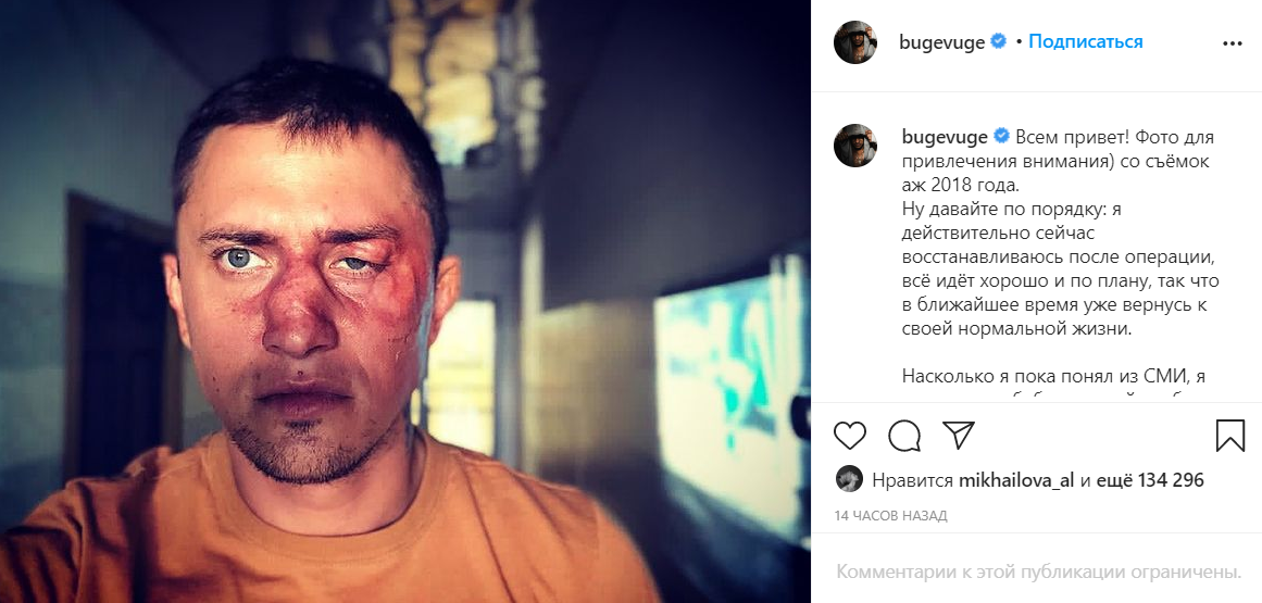 Павел прилучный операция фото "Подрался за бабушку": Подробности госпитализации актёра Павла Прилучного