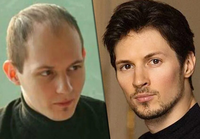 Павла 2 фото Фанаты уверены, что Дуров сделал наращивание или пересадку волос WOMAN