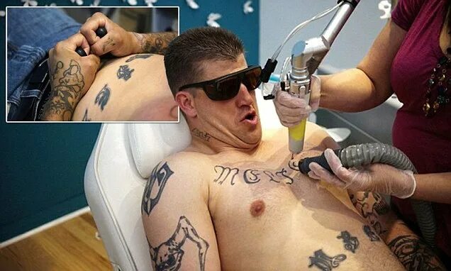 Перевести фото в тату Inside Colorado's 'What Were You Inking?' tattoo removal clinic for ex-cons