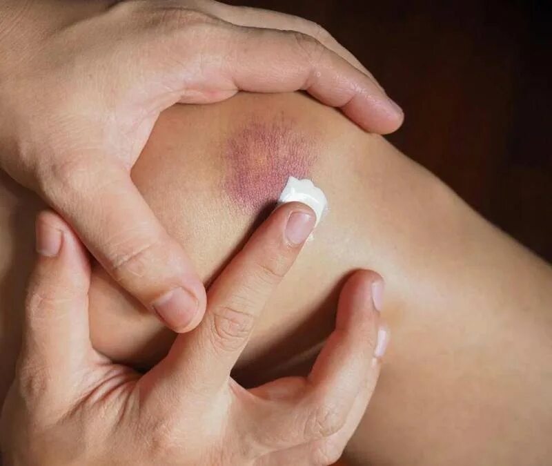 Первая стадия пролежней фото Пролежни у пожилых: лечение и недопущение в дальнейшем