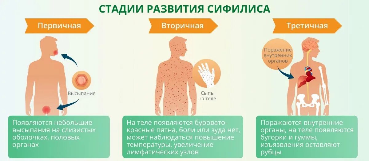Первая стадия сифилиса фото Анализ на сифилис: как сдают, как подготовиться, как проводят и сколько стоит ан