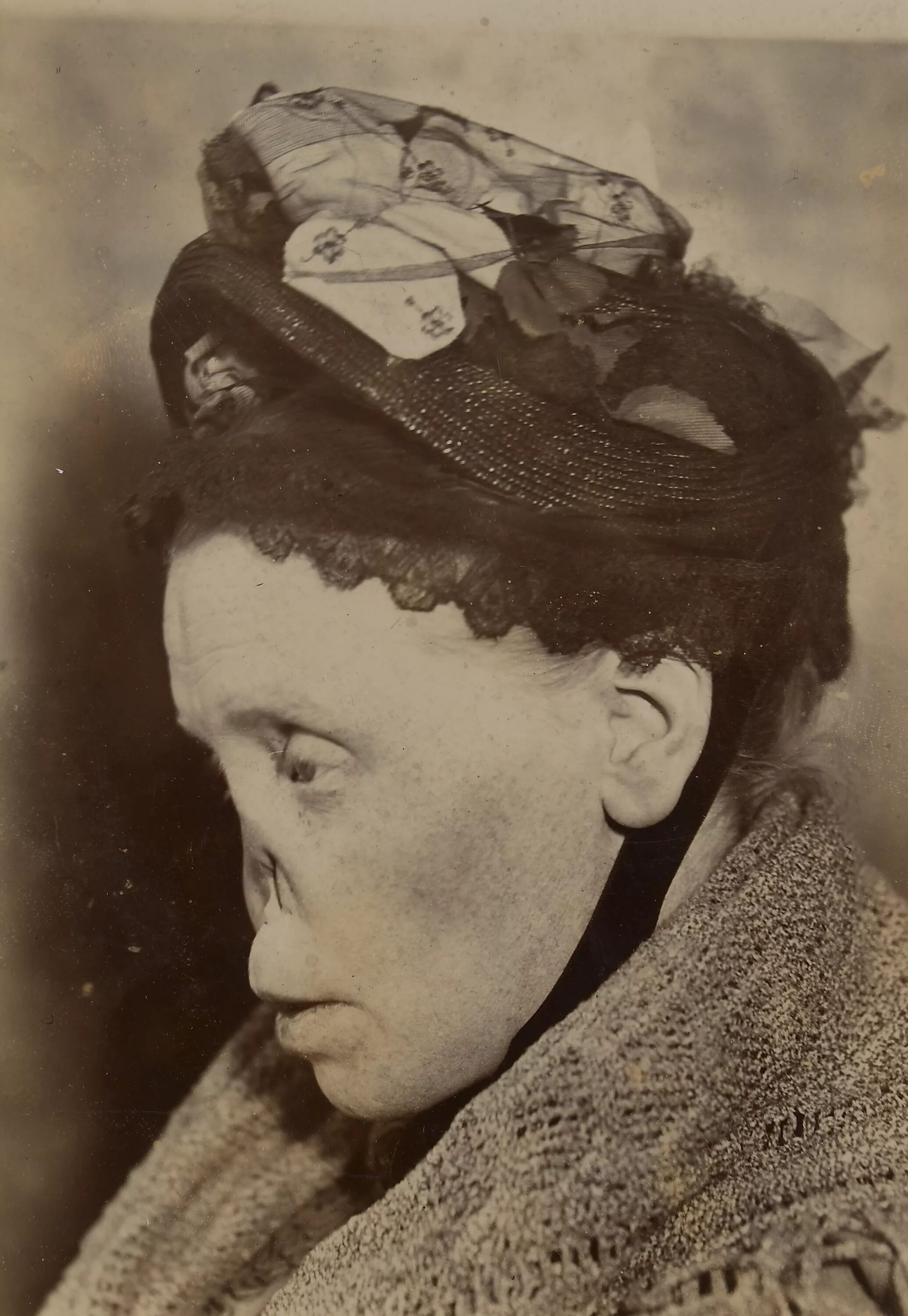 Первая стадия сифилиса фото File:Face of a woman with a typical 'syphilitic nose' Wellcome L0062956.jpg - Wi