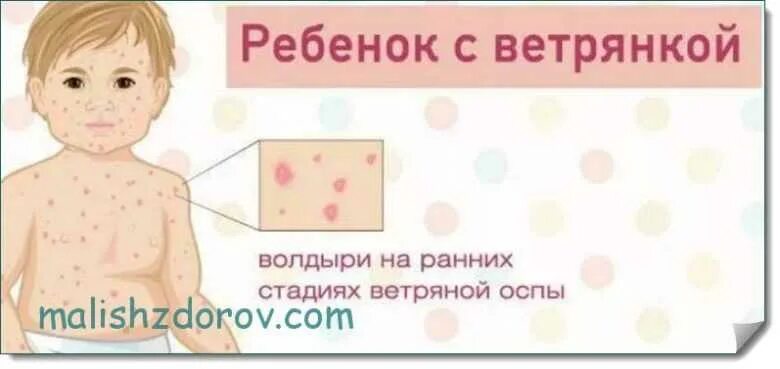 Первая стадия ветрянки у детей фото Высыпания на теле у ребенка в виде прыщиков: фото с пояснениями, причины возникн