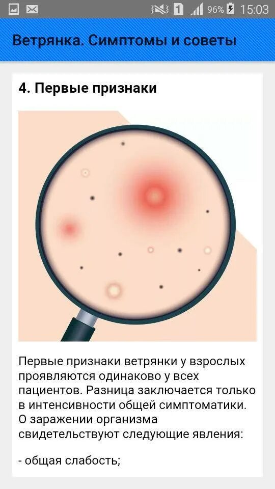 Первая стадия ветрянки у детей фото Какой иммунитет после ветрянки: найдено 30 изображений