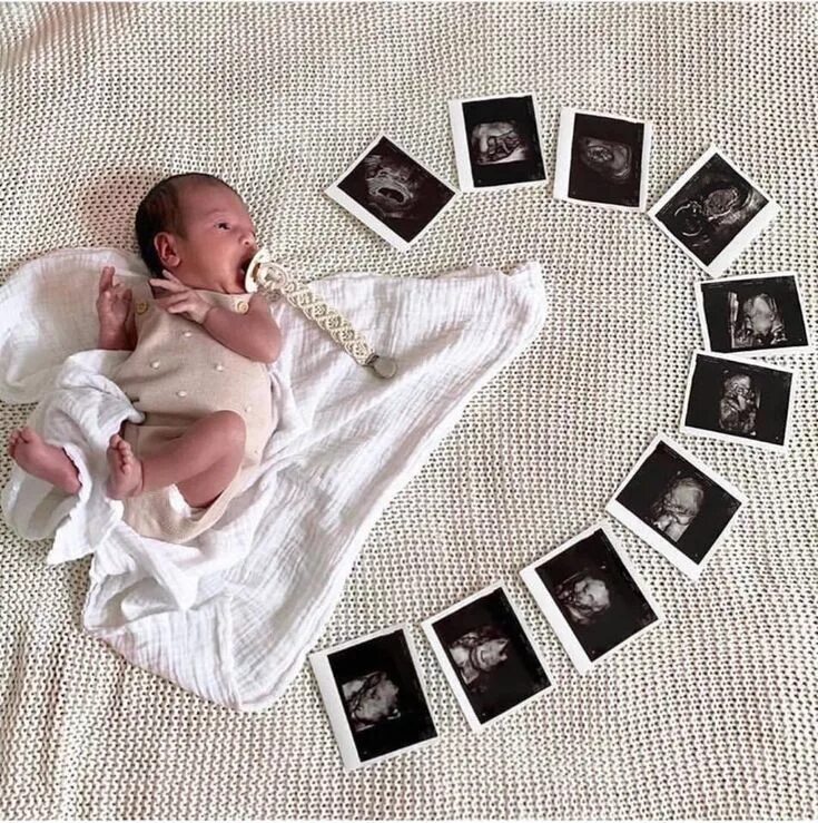 Первый месяц фото Baby and ultrasound photo idea Newborn baby photos, Newborn baby photography, Ba