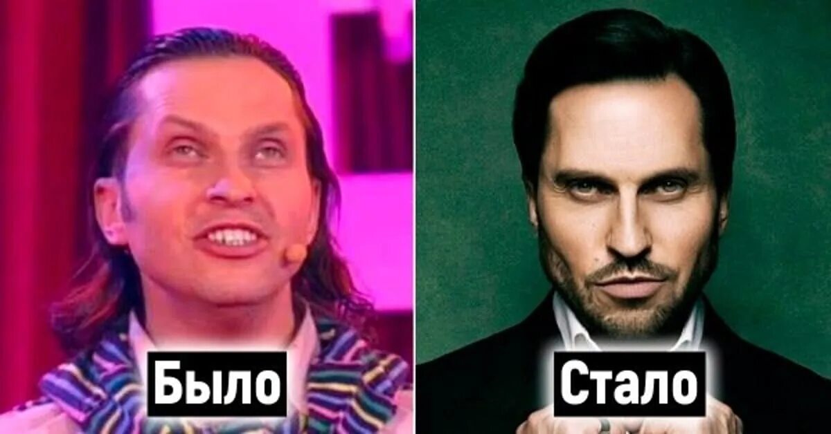 Пирожков фото до и после пластики SHAMAN поучаствовал в составе жюри нового выпуска КВН SHAMAN ПРО Дзен