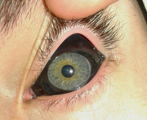 Пирсинг глазного яблока фото Rhubarbes Eyeball tattoo, Eye photography, Eye tattoo