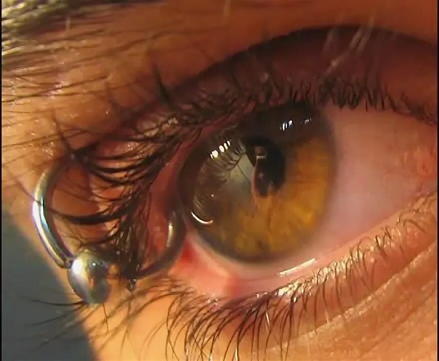 Пирсинг глазного яблока фото Pin de Erika Leonela en Piercing- Tipos de piercing, Piercing