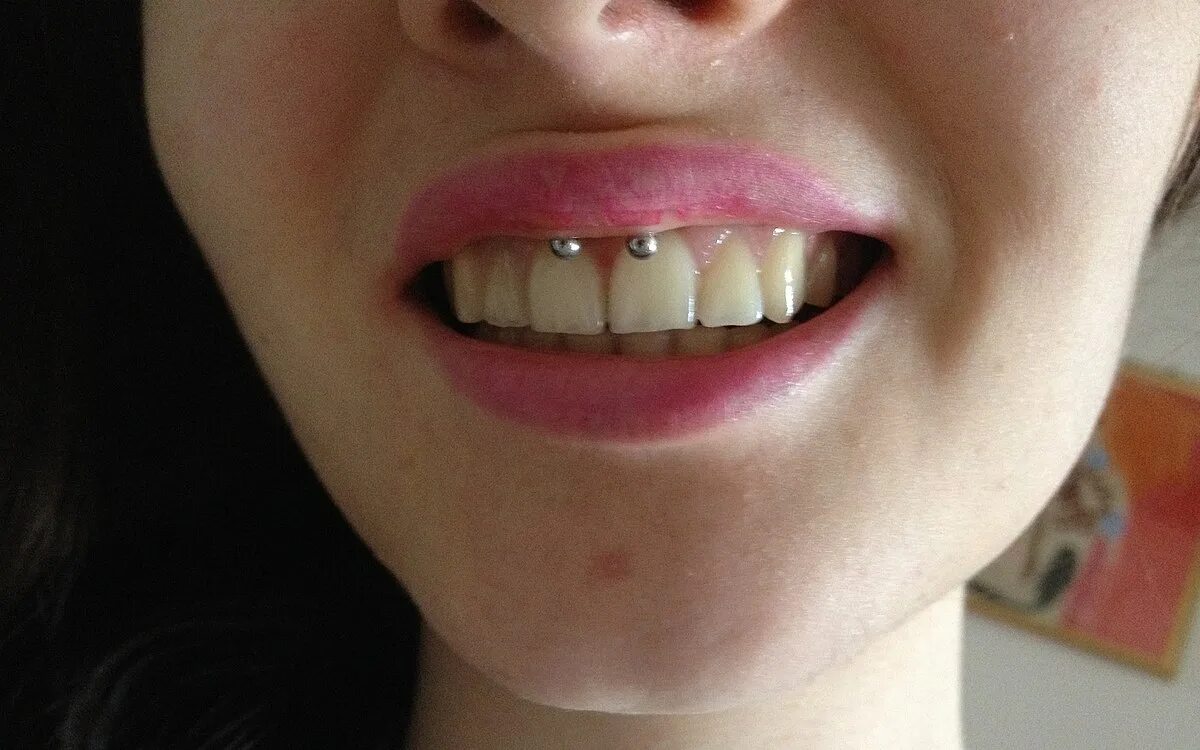 Пирсинг под верхней губой фото Berkas:Piercing smiley.JPG - Wikipedia bahasa Indonesia, ensiklopedia bebas