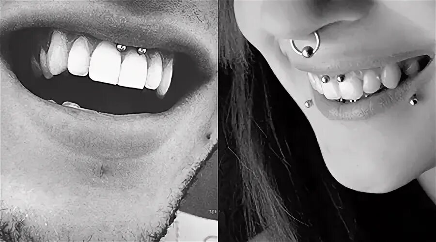 Пирсинг уздечки верхней губы последствия фото 25.12.17# piersing #microdermal #calipso #ivanovo #пирсинг #микродермал #украшен