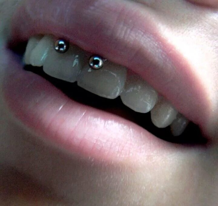 Пирсинг уздечки верхней губы последствия фото Пин на доске Piercing Пирсинг на лице, Серьги для пирсинга, Пирсинг губы