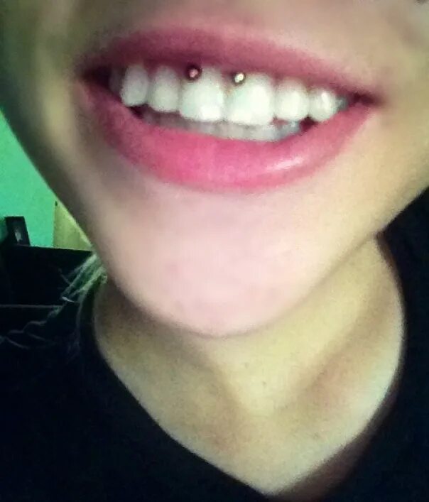 Пирсинг уздечки верхней губы последствия фото Записи по тегу #smile BP (18+) - beautiful piercing ВКонтакте