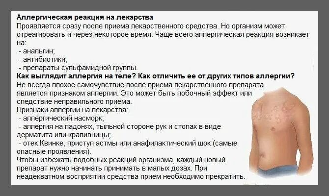 Пищевая аллергия как выглядит сыпь Зуд и покраснение кожи на теле ребенка в виде пятен: симптомы аллергии и других 