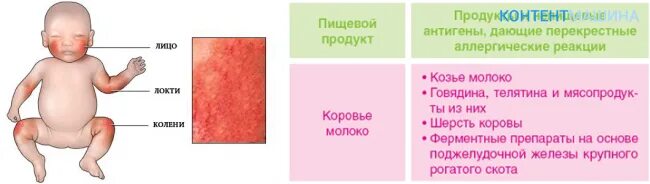 Пищевая аллергия как выглядит сыпь Маленькие красные прыщики у грудничка на разных частях тела