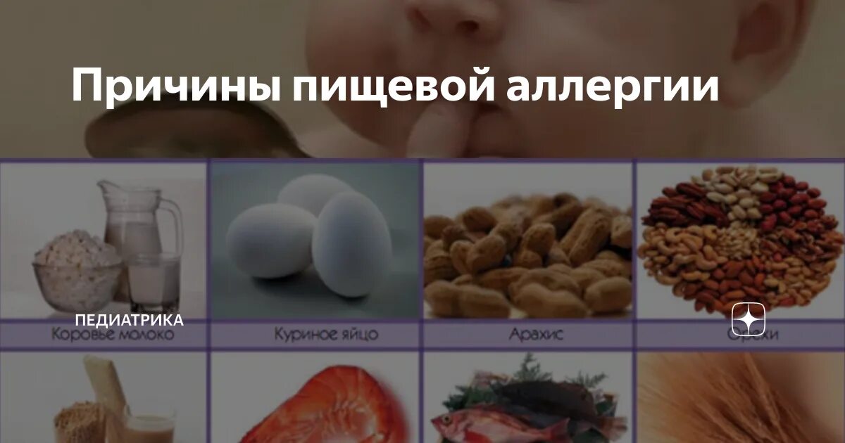 Пищевая аллергия симптомы у взрослого фото Аллергия на сладкое и сахар у детей: симптомы с фото, диагностика и лечение