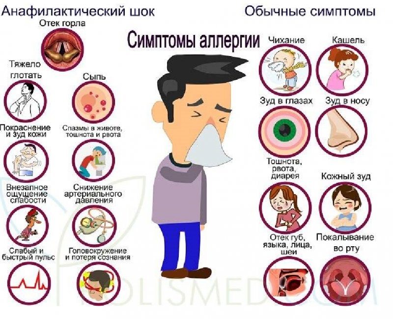 Пищевая аллергия симптомы у взрослого фото Неотложная помощь при острых аллергических реакциях КГБУ "Бикинский реабилитацио