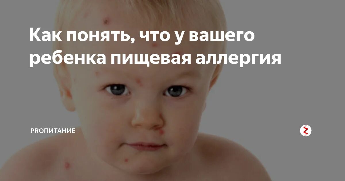 Пищевая аллергия у детей фото сыпи Как проявляется аллергическая реакция у грудничков на сладости, способы лечения