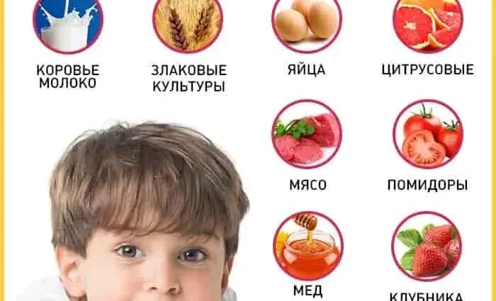 Пищевая аллергия у детей фото сыпи Как проявляется аллергическая реакция у грудничков на сладости, способы лечения