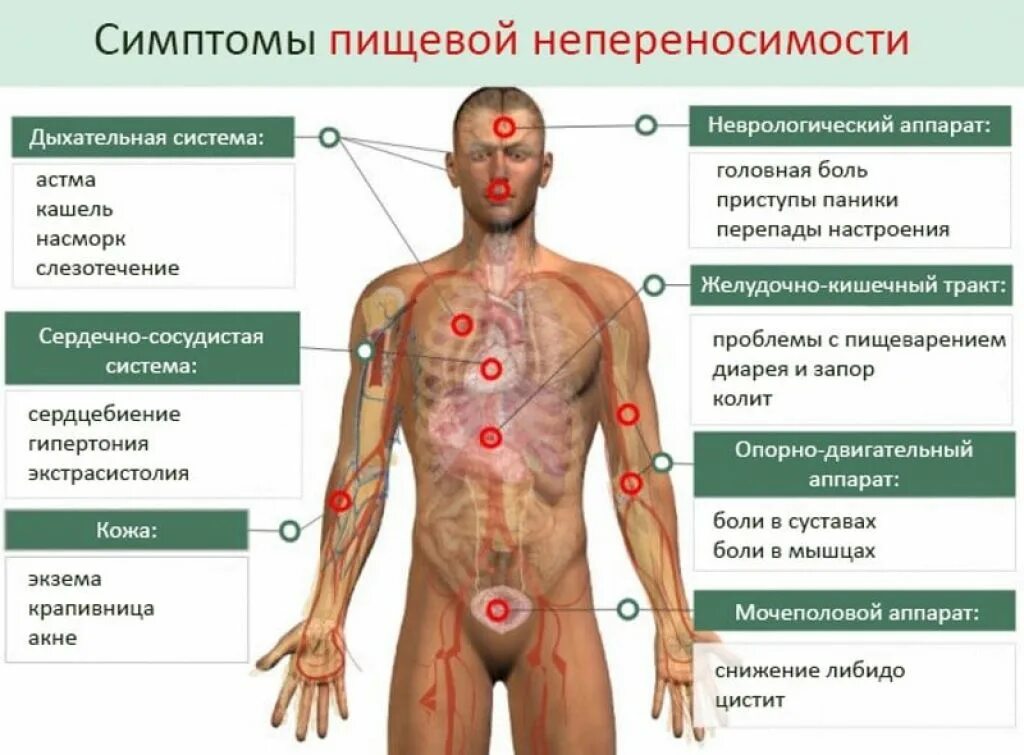 Пищевой аллергия симптомы лечение фото Нелли Акбердина: "Аллергия сильно ухудшает качество жизни, и лечить её нужно обя