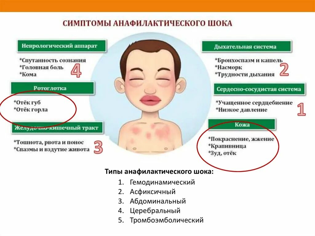 Пищевой аллергия симптомы лечение фото Аллергия у детей симптомы: найдено 30 изображений