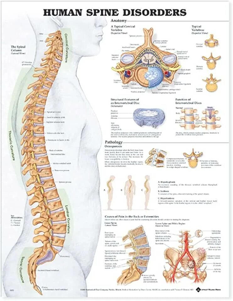 Плакат позвоночник и болезни медицинский фото Amazon.com: Posture Chart