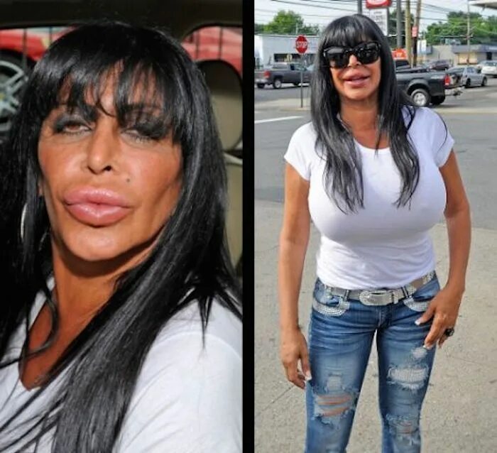 Пластика девушки фото Pin by Fluff n Buff on Guilty Pleasure-Reality TV Bad celebrity plastic surgery,