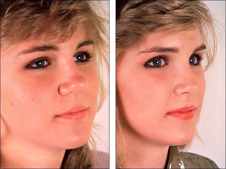 Пластика носа фото после операции Pin by Elizabeth Sanchez on DIY Christmas gifts Nose plastic surgery, Plastic su