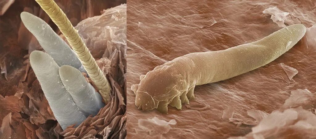 Подкожные клещи фото на теле Uno zoo di Demodex per tutti! - Microbiologia Italia