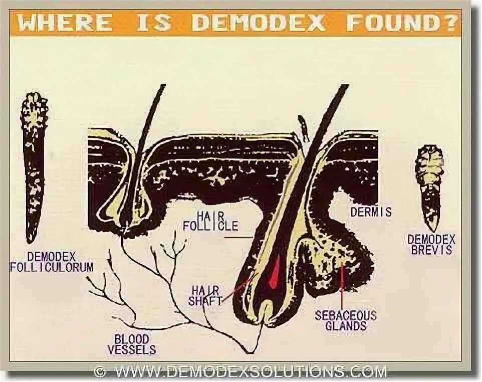 Подкожный клещ фото отзывы Demodex Mites: Understanding and Treating Skin Conditions