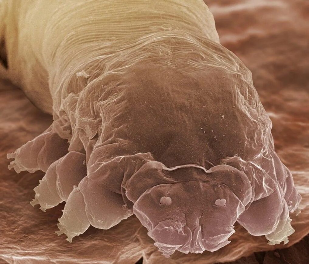 Подкожный клещ на ногах фото FACE OF EYELASH MITE Things under a microscope, Demodex, Microscopic images