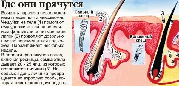 Подкожный клещ на руках фото Azelaic acid. Drugs that act on the skin, the instruction for use in cosmetics