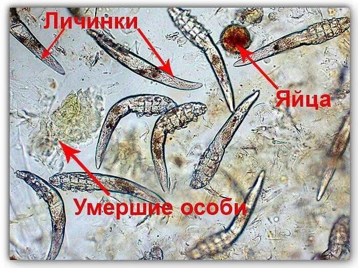 Подкожный клещ у крс фото Провериться на клещ демодекс ( анализ взятия ресниц) 2024 ОФТАЛЬМОЛОГ в БЕЛГОРОД