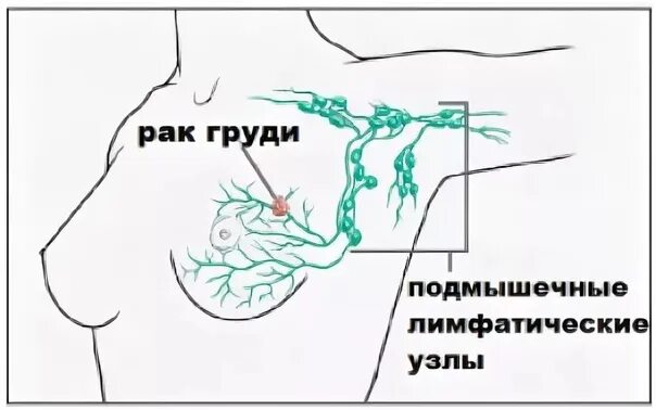 Подмышечные лимфоузлы расположение у женщин схема Пользователи искали