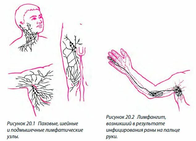 Подмышечные лимфоузлы расположение у женщин схема Кожные болезни - MirMarine