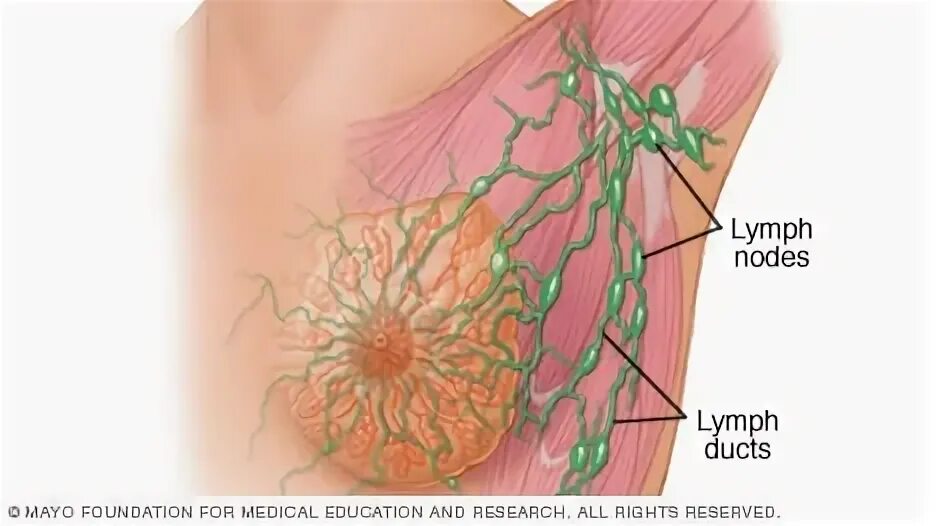 Подмышечные лимфоузлы расположение у женщин схема Mastitis - Síntomas y causas - Mayo Clinic