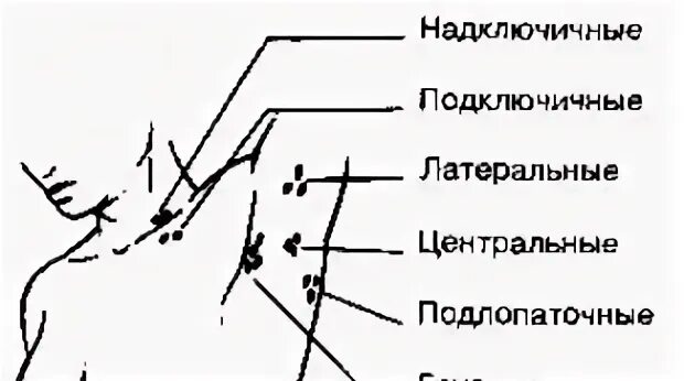 Подмышечные лимфоузлы расположение у женщин схема Картинки ПОДМЫШЕЧНЫЕ ЛИМФОУЗЛЫ СХЕМА