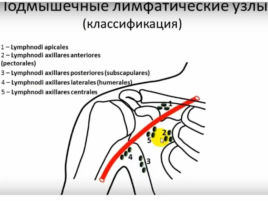 Подмышечные лимфоузлы расположение у женщин схема Подмышечные лимфатические узлы