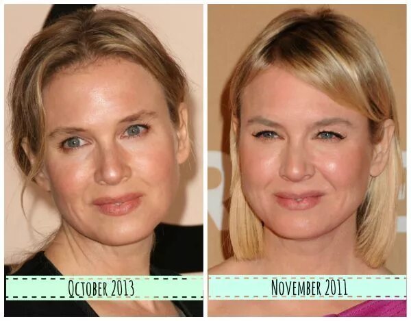 Поднять веки ботоксом фото Renee Zellweger now and then - What did she do to her face?? Renee zellweger, Pl