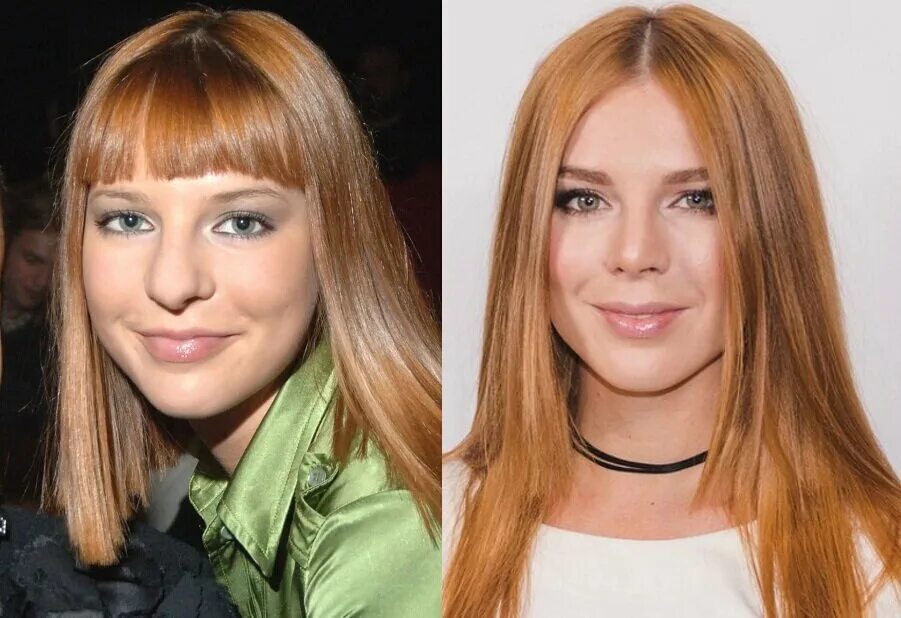 Подольская до и после пластики носа фото Мария Максакова и другие звёзды до пластики носа и после В мире искусства и разв