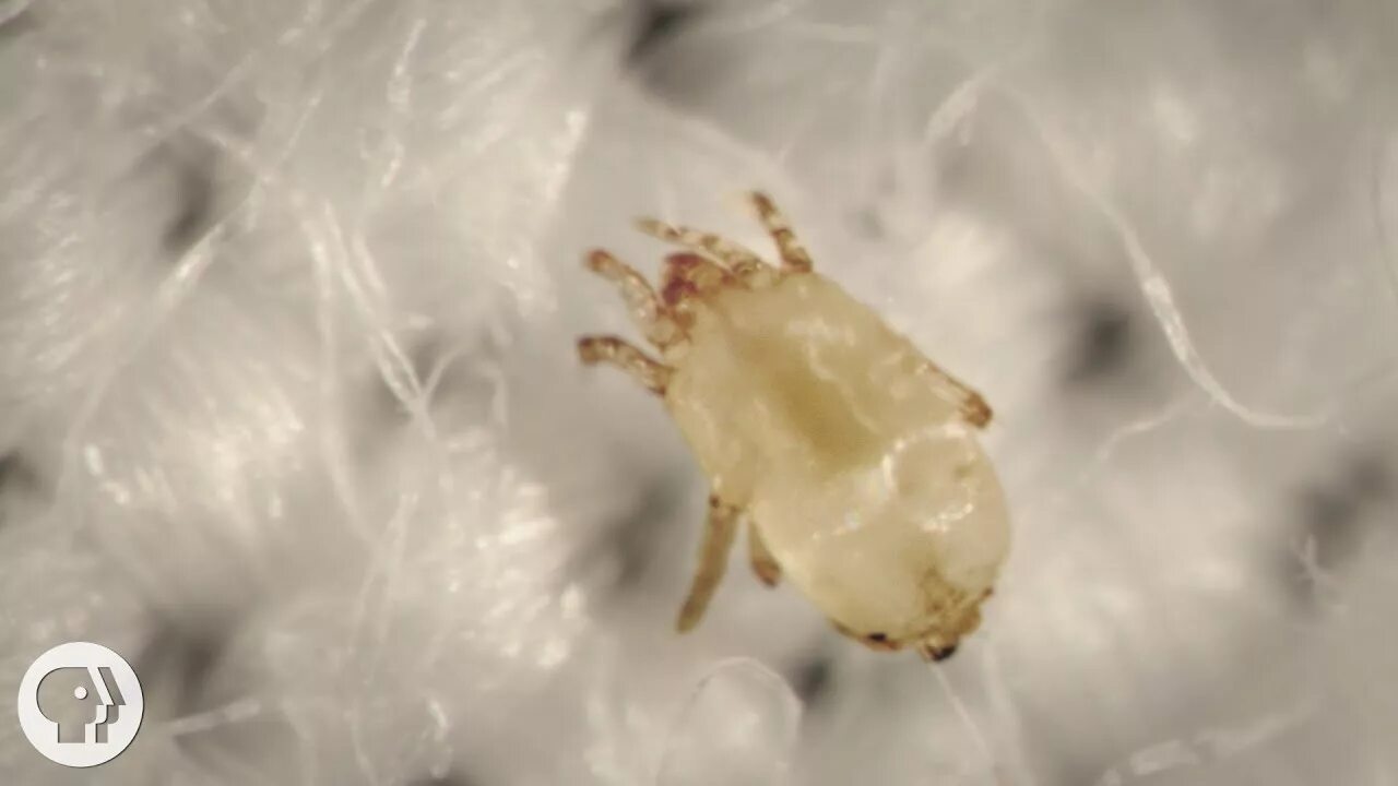 Подушечные клещи фото Meet the Dust Mites, Tiny Roommates That Feast On Your Skin Deep Look - YouTube