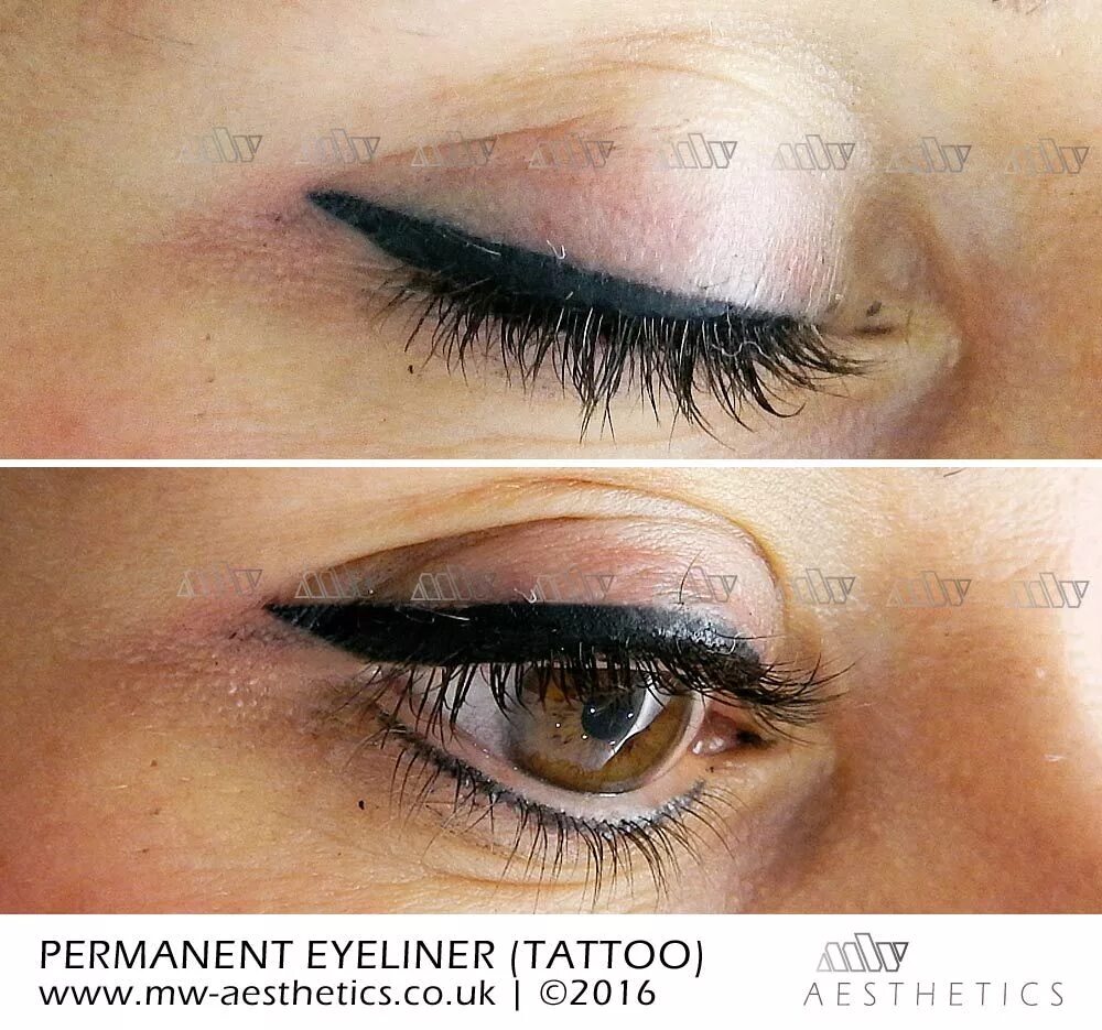 Подводка татуаж permanent eyeliner (tattoo) picture taken straight after the procedure Eyeliner 