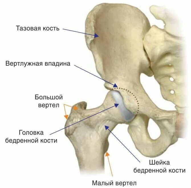 Подвздошная кость где находится фото Типы протезов при эндопротезировании тазобедренного сустава